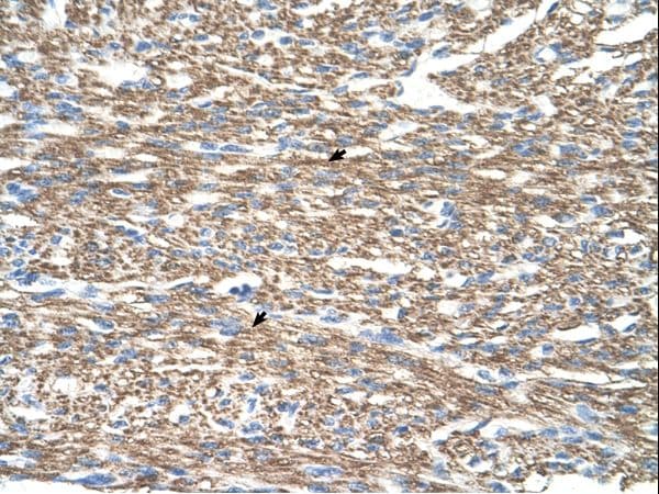 Polyclonal Rabbit anti-Human COXIV / COX4 Antibody (N-Terminus, IHC, WB)