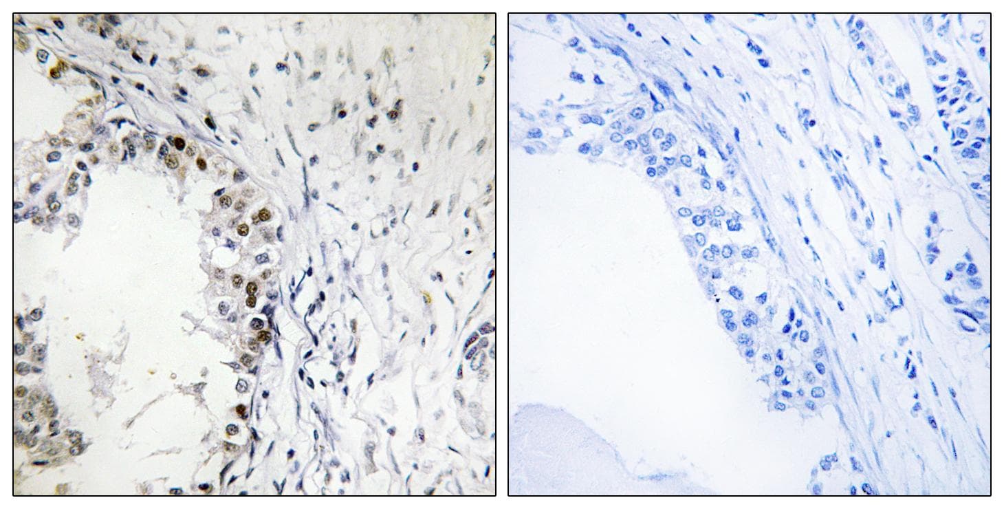 Polyclonal Rabbit anti-Human MKNK1 / MNK1 Antibody (phospho-Thr250, IHC)