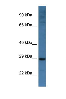 NIX / BNIP3L Antibody (aa92-141)