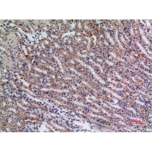 JAG1 / Jagged 1 Antibody (981-1030 aa, Internal)