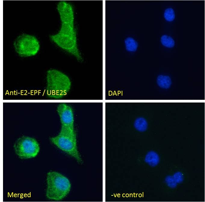 UBE2S / E2 EPF Antibody (aa2-14)