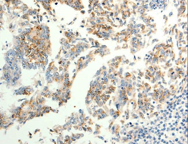 TRPC6 Antibody