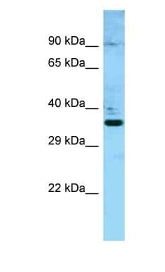 Polyclonal Rabbit anti-Human DMC1 Antibody (aa50-99, WB)