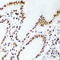 RBBP7 / RbAp46 Antibody