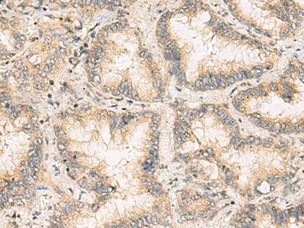 NANP Antibody