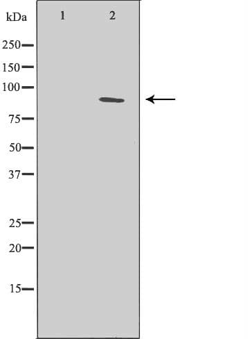 ERCC3 / XPB Antibody