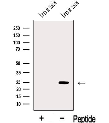 IFT43 / C14orf179 Antibody