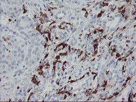 F13A1 / Factor XIIIa Antibody (clone OTI3F1)