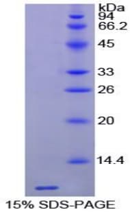 Horse TMSB4X / Thymosin Beta-4 Protein (Recombinant His)