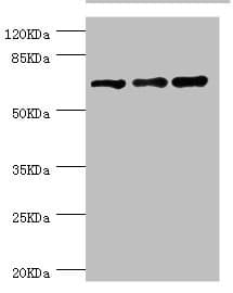 Polyclonal Rabbit anti-Human RNGTT / HCAP Antibody (IHC, WB)