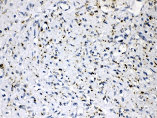 PLIN2 / ADFP / Adipophilin Antibody