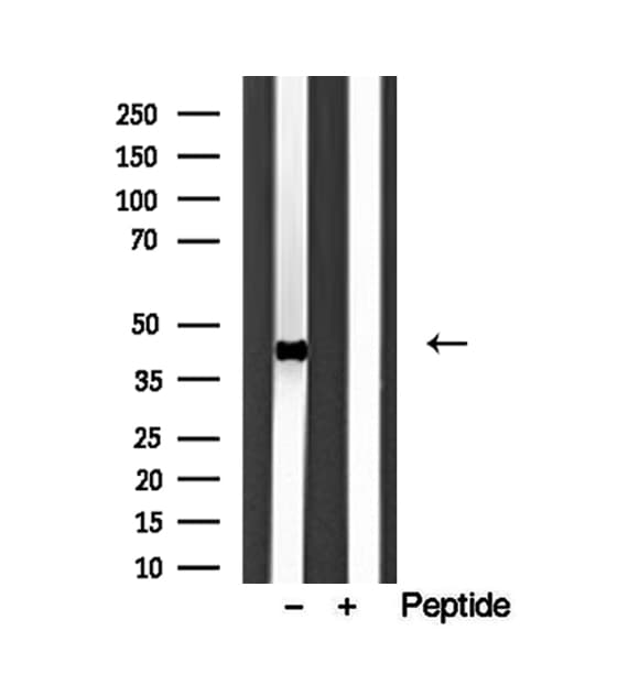HLA-E Antibody