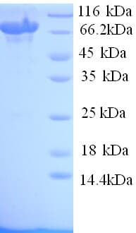 Human TLR8 Protein (Recombinant 6His, N-terminus)
