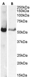 Polyclonal Rabbit anti-Mouse GCGR / Glucagon Receptor Antibody (IHC, WB)