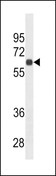 IHC-plus™ Monoclonal Mouse anti-Human SDC1 / Syndecan 1 / CD138 Antibody (aa210-238, IHC, IF, WB)