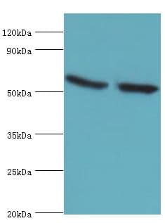Polyclonal Rabbit anti-Human GBA3 / CBG Antibody (aa1-162, IHC, WB)