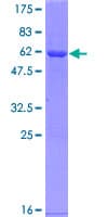 Human CCS Protein (Recombinant GST)