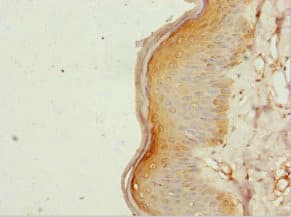 ZC3HC1 / NIPA Antibody