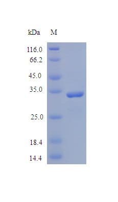Human Osteonectin / SPARC Protein (Recombinant)