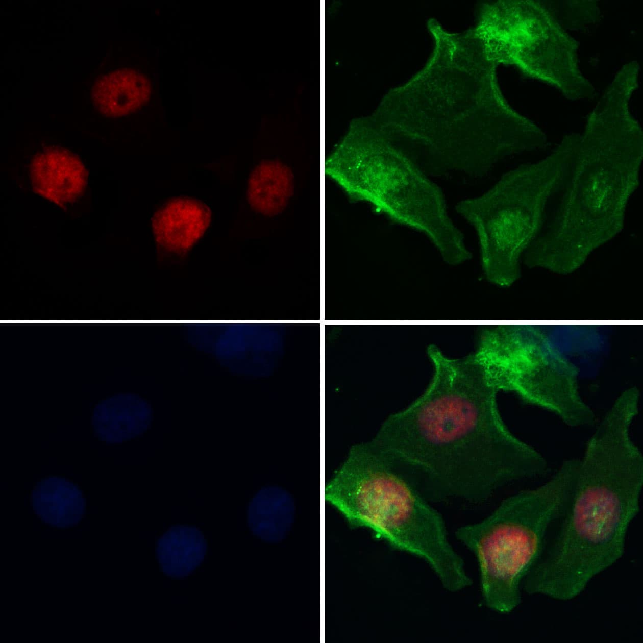 HELLS Antibody