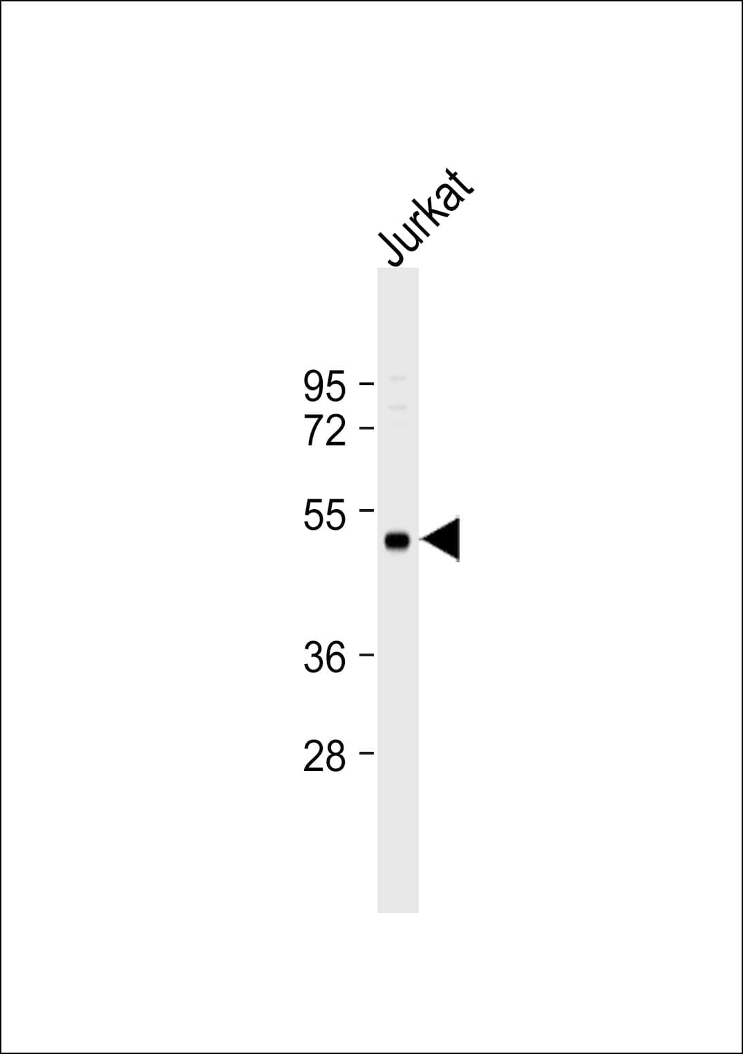 SH2D2A Antibody