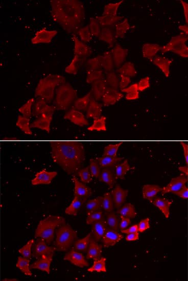 MAC-2-BP / LGALS3BP Antibody