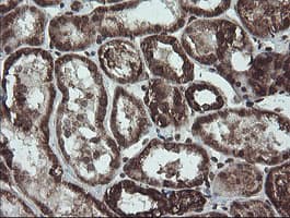 NDUFB10 Antibody (clone OTI1H6)