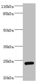 Amisyn / STXBP6 Antibody (aa2-210)