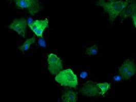 CTAG1B / NY-ESO-1 Antibody (clone OTI5E1)