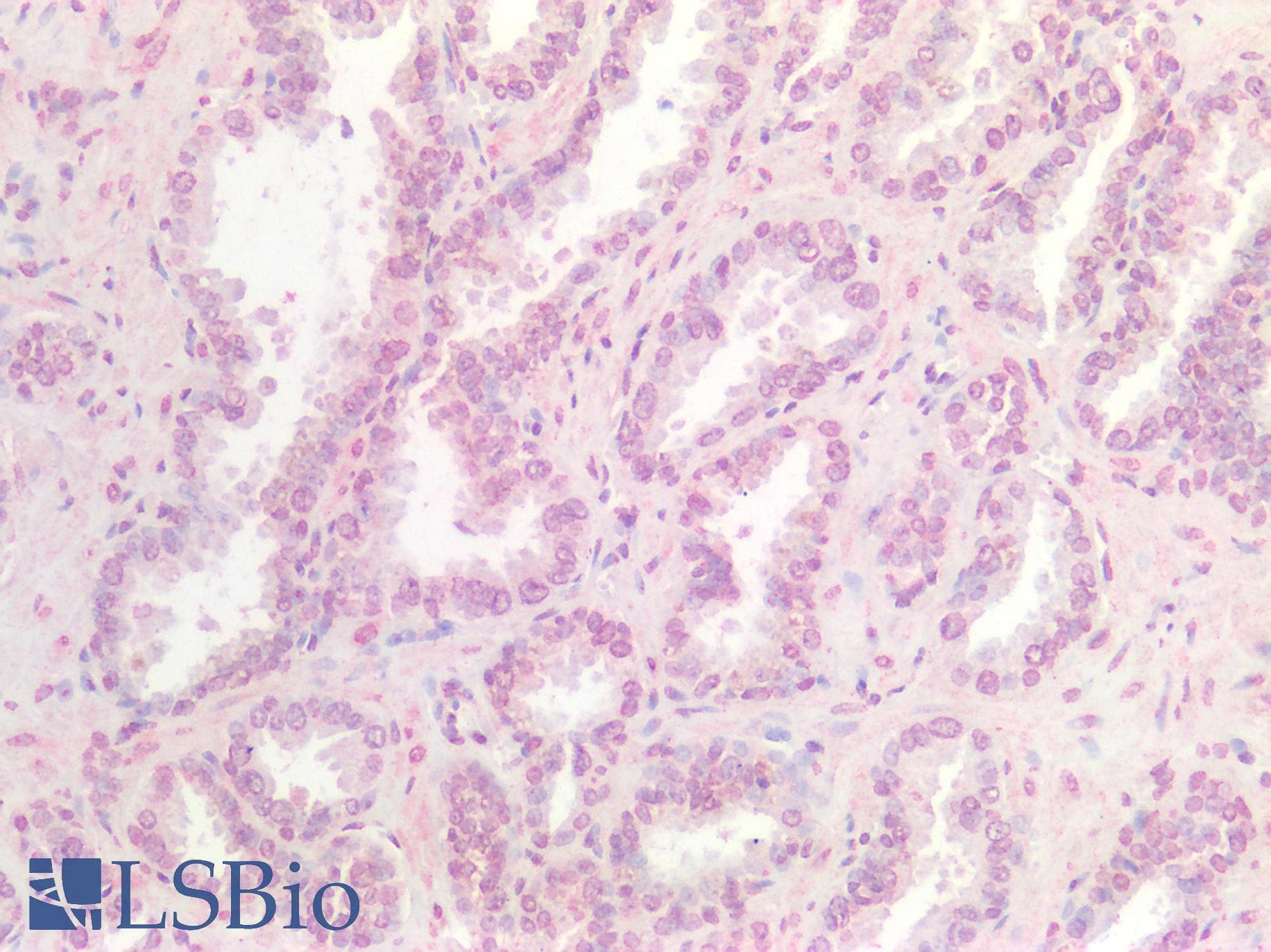 PathPlus™ Polyclonal Rabbit anti-Human WNT9B / WNT15 Antibody (Internal, IHC)