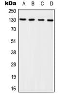 Polyclonal Rabbit anti-Human BCAR1 / p130Cas Antibody (phospho-Tyr249, IF, WB)