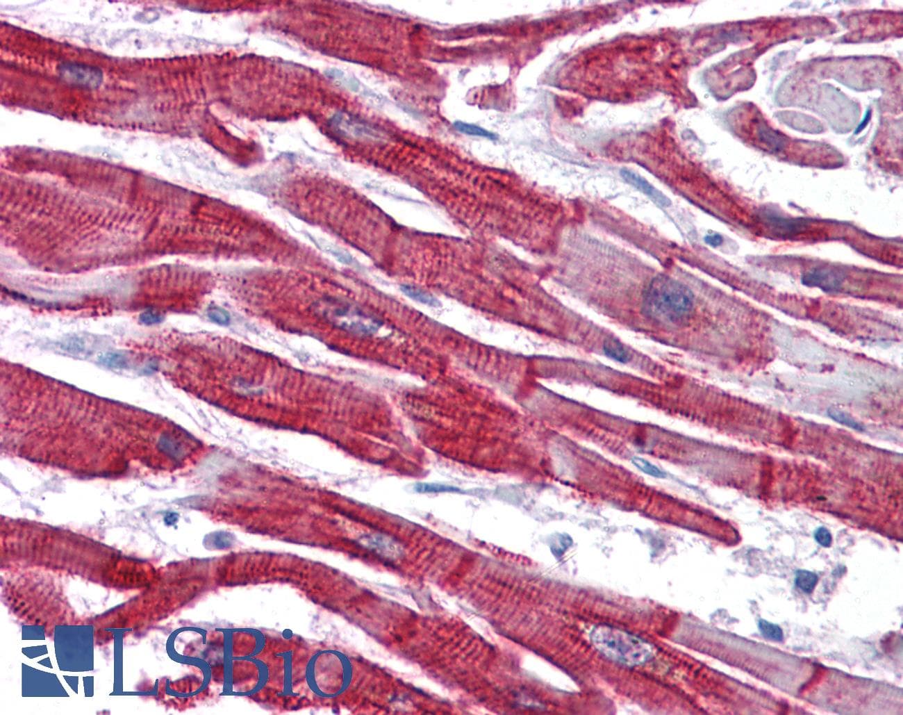 IHC-plus™ Polyclonal Goat anti-Human DES / Desmin Antibody (aa454-468, IHC, WB)