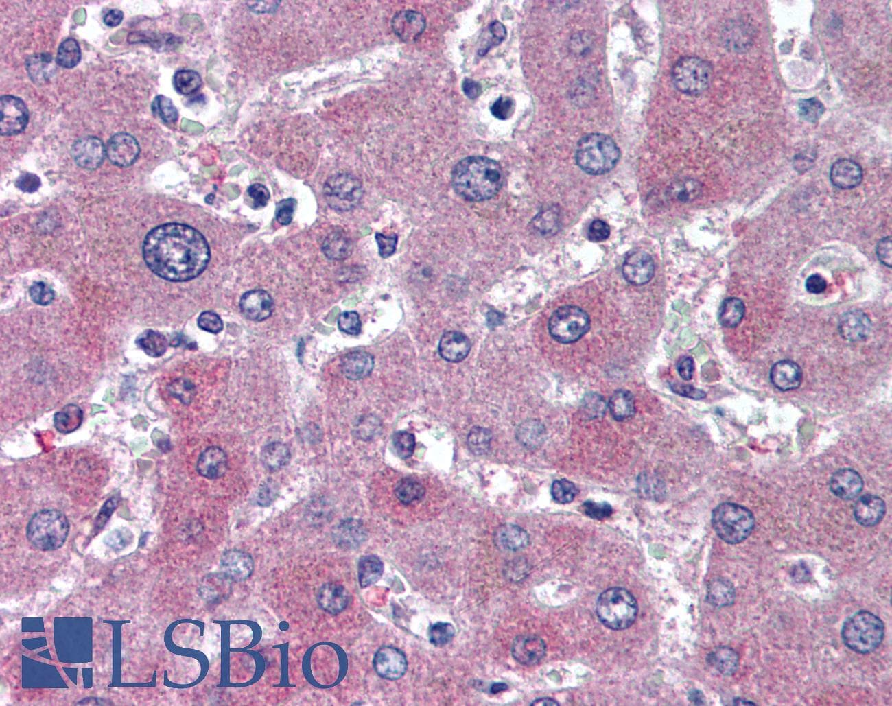 IHC-plus™ Monoclonal Mouse anti-Human ABCB11 / BSEP Antibody (aa705-718, IHC, WB)
