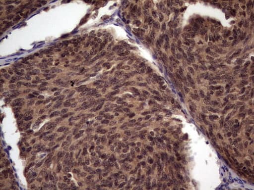 UFD1L Antibody (clone OTI7C9)