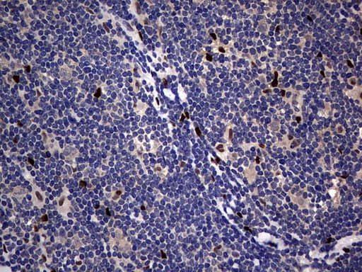Monoclonal Mouse anti-Human PRX-1 / PRRX1 Antibody (clone OTI6A4, IHC, WB)