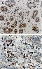RIPK1 / RIP Antibody (aa269-287)