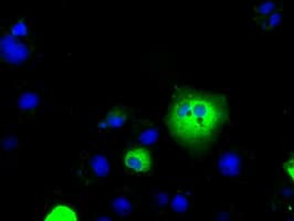 SLC7A8 / LAT2 Antibody (clone OTI2D4)
