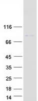 Human OSBPL9 Protein (Recombinant Myc-DDK (Flag))