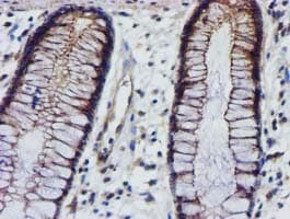 EPN2 Antibody (clone OTI1C5, Carrier-free)