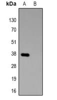GST Tag Antibody