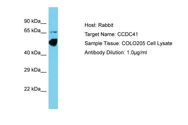 Polyclonal Rabbit anti-Human CEP83 / CCDC41 Antibody (aa148-197, WB)