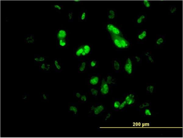 PathPlus™ FOXA2 Antibody (clone 1C7)