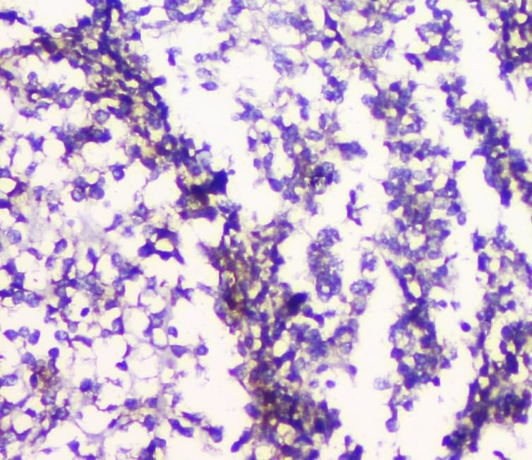 HTR2A / 5-HT2A Receptor Antibody (aa400-431)