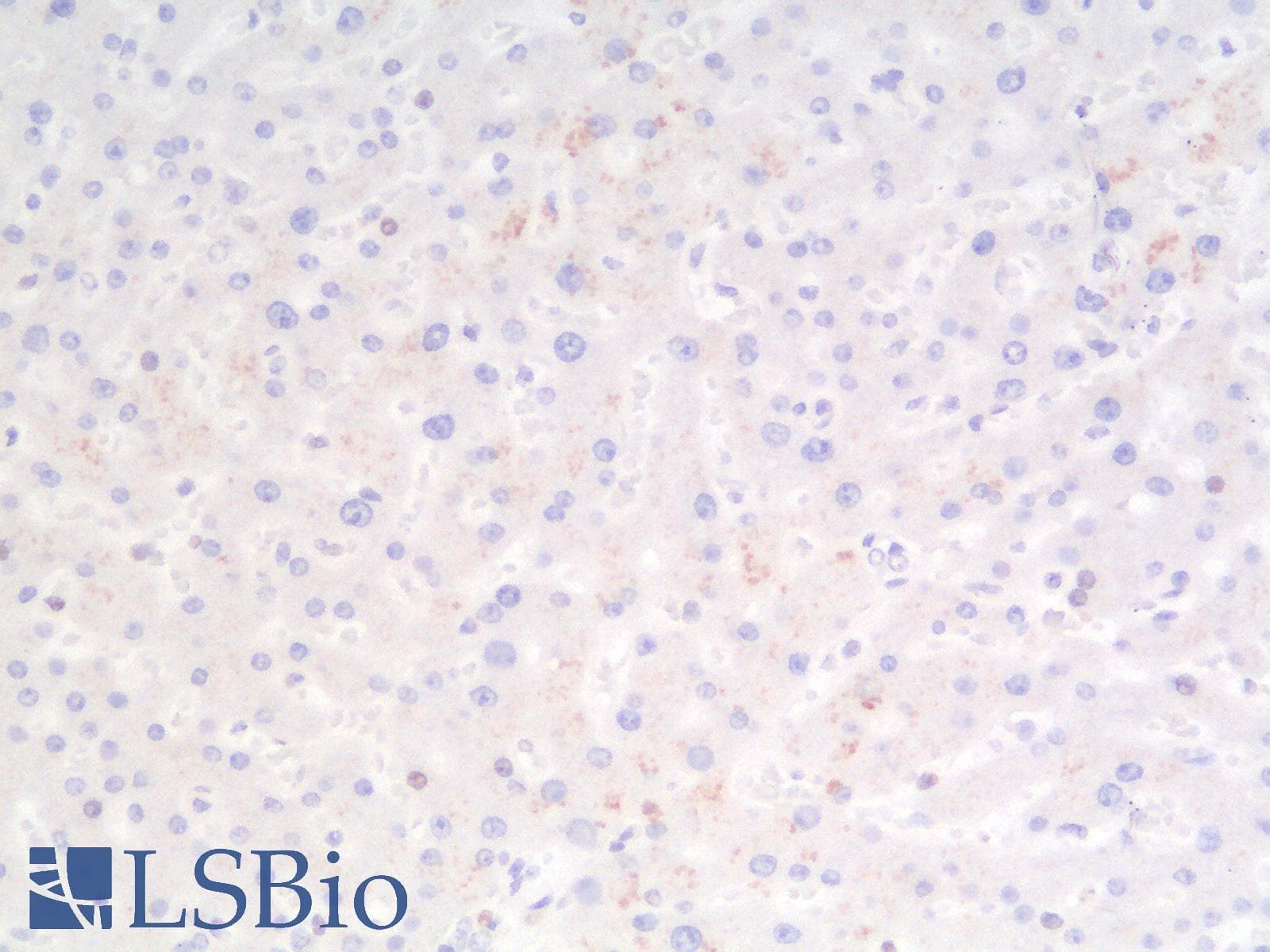 IHC-plus™ NAPSA / NAPA / Napsin A Antibody (aa189-299, clone rNAPSA/1239)