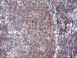 RFXANK Antibody (clone OTI2F12)