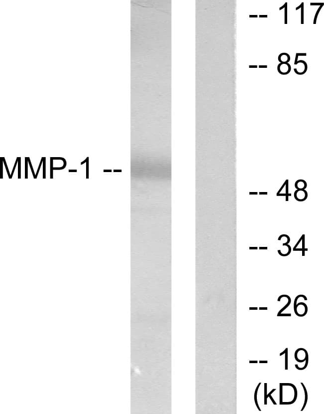 Polyclonal Rabbit anti-Human MMP1 Antibody (aa411-460, WB)