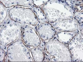Monoclonal Mouse anti-Human ARH / LDLRAP1 Antibody (clone OTI4B10, IHC, WB)