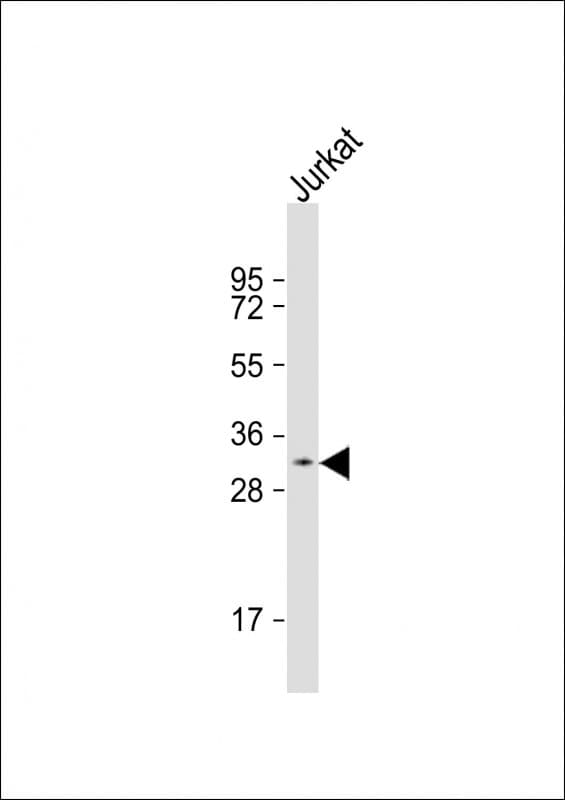 PRSS42 Antibody (aa207-241)