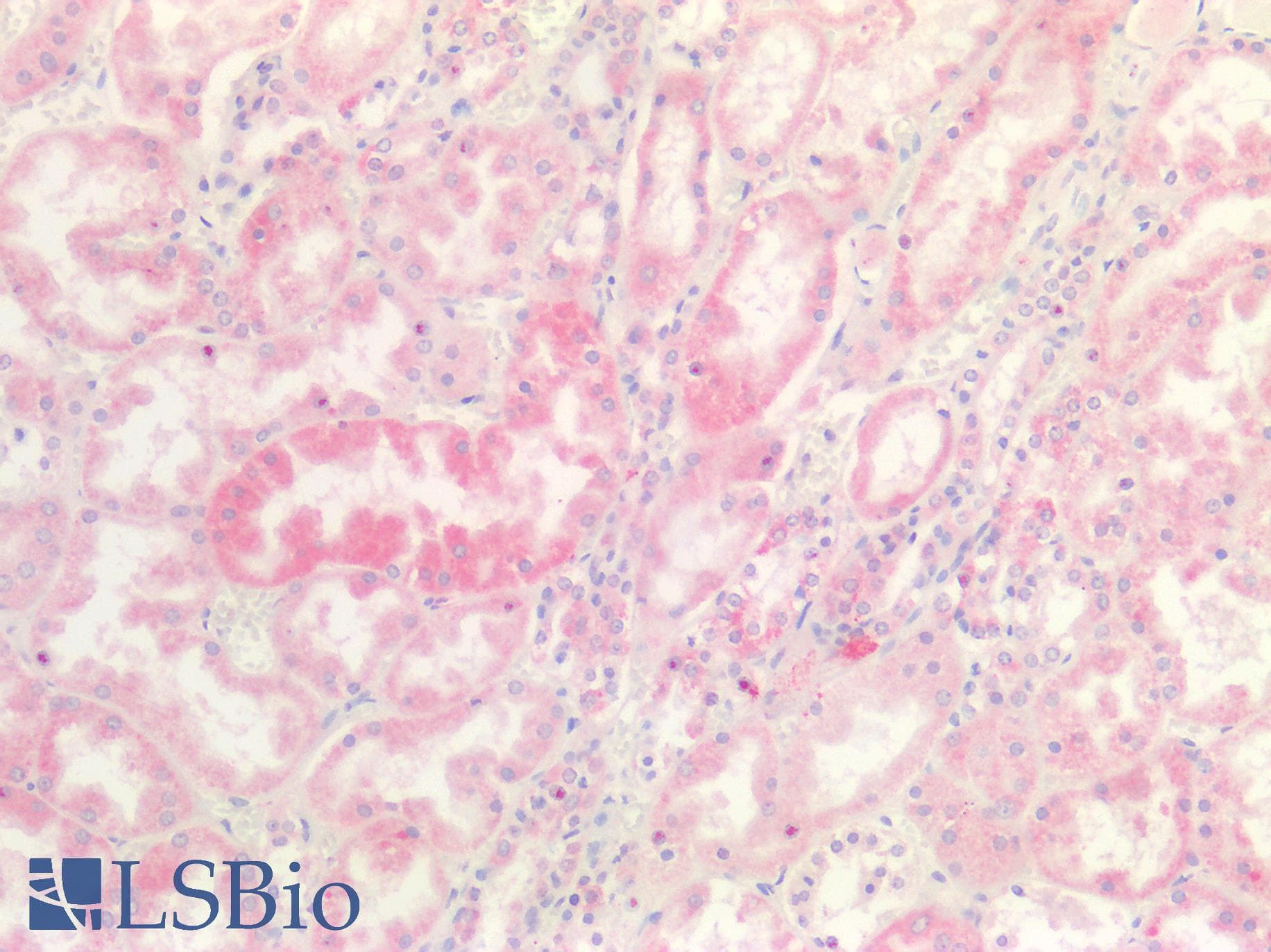 IHC-plus™ Polyclonal Rabbit anti-Human INSR / Insulin Receptor Antibody (Internal, IHC)