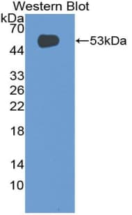 GP9 / CD42a Antibody (aa1-189)
